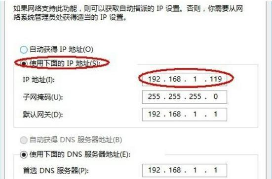 如何设置电脑的IP地址和DNS？（简单易懂的教程帮助您完成设置）